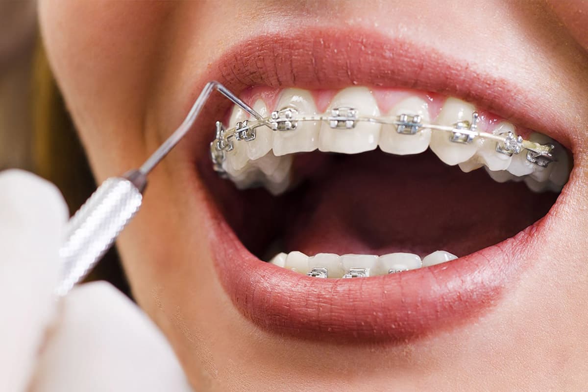 Orthodontie